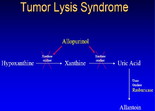 tumor lysis syndrome 2